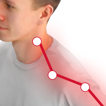 Neck Pain and Stiffness